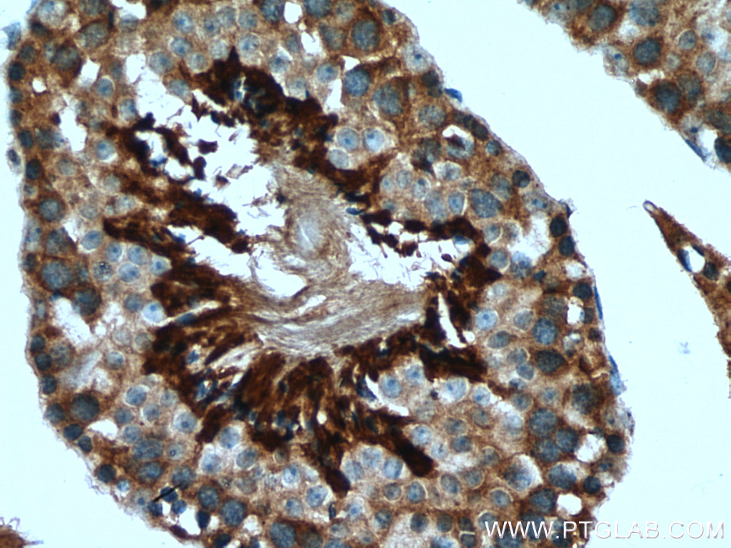 NRD1 Polyclonal antibody