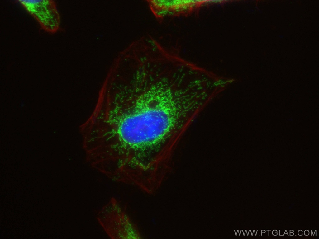 HSDL2 Polyclonal antibody