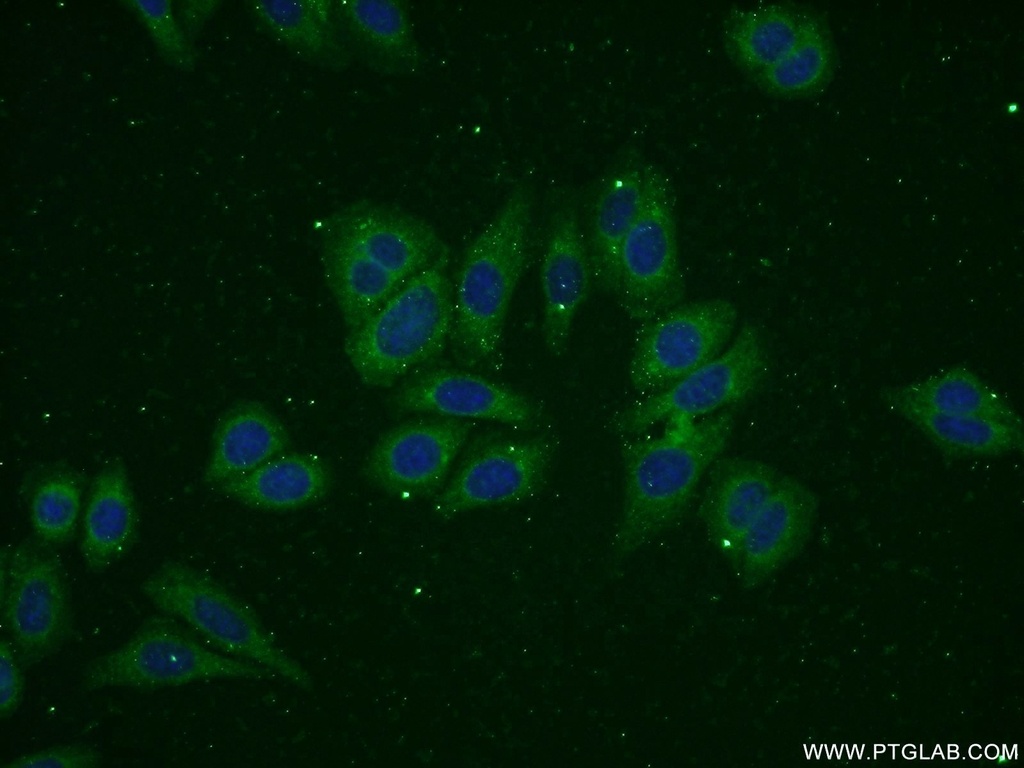 ADPGK Polyclonal antibody