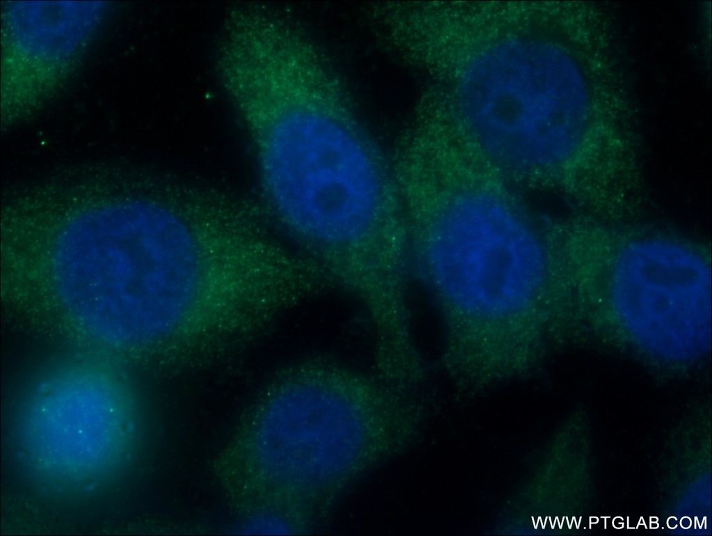 SH2D3A Polyclonal antibody