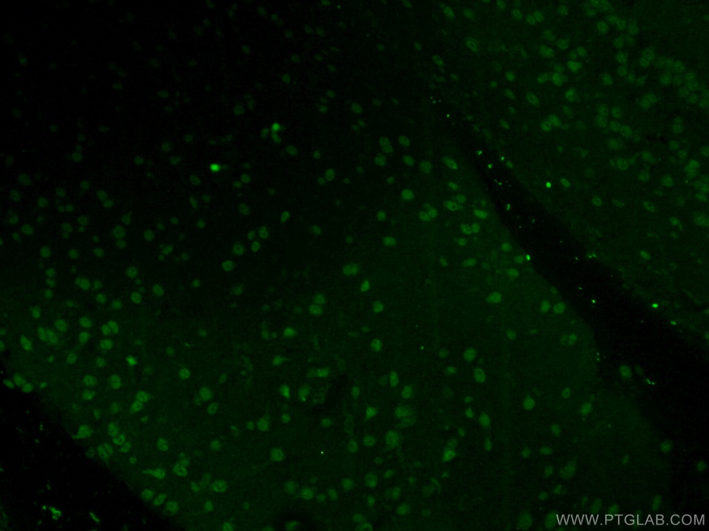 POM121 Polyclonal antibody