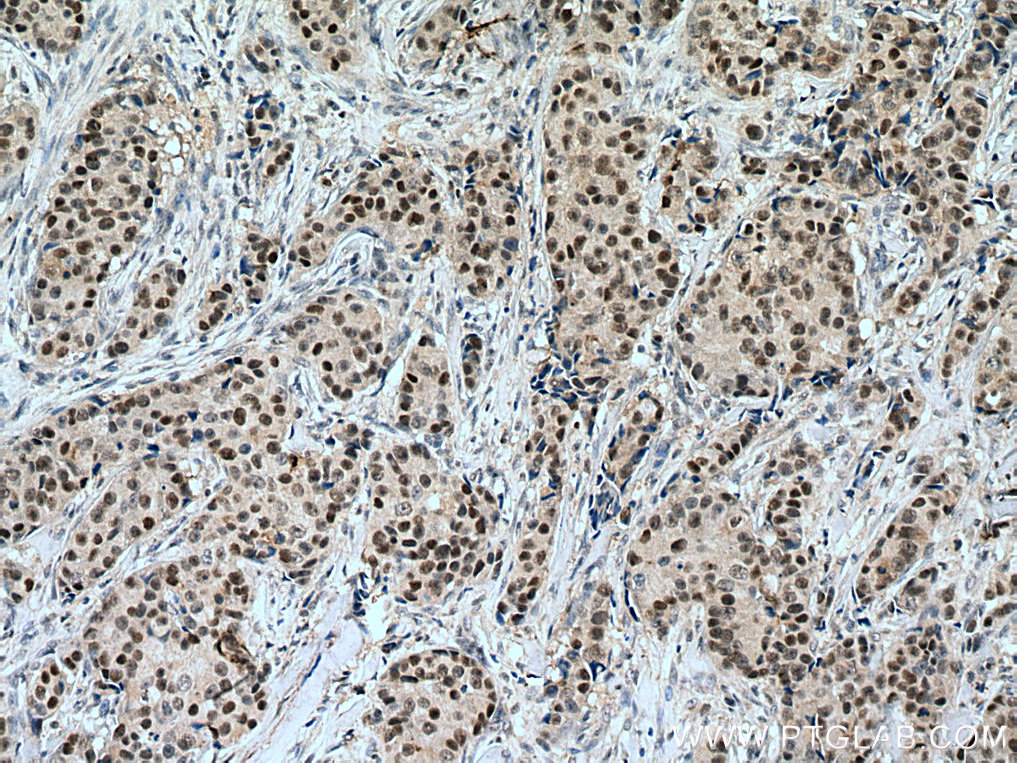 POLD1 Polyclonal antibody