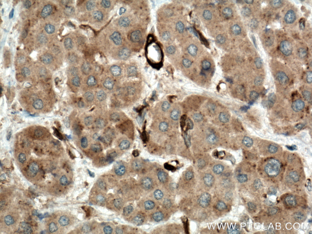 IKBKB Polyclonal antibody