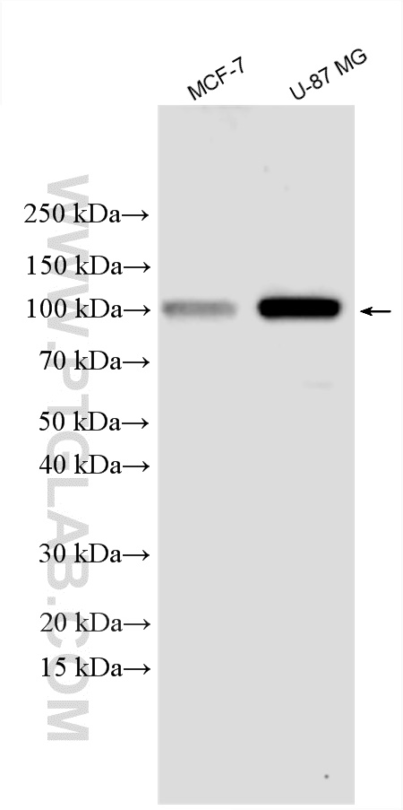 HK1 Polyclonal antibody