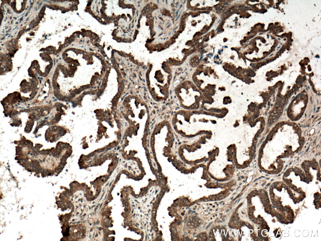 RAB14 Polyclonal antibody