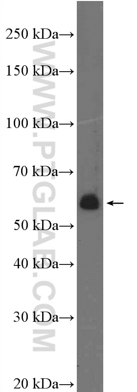 PHF1 Polyclonal antibody
