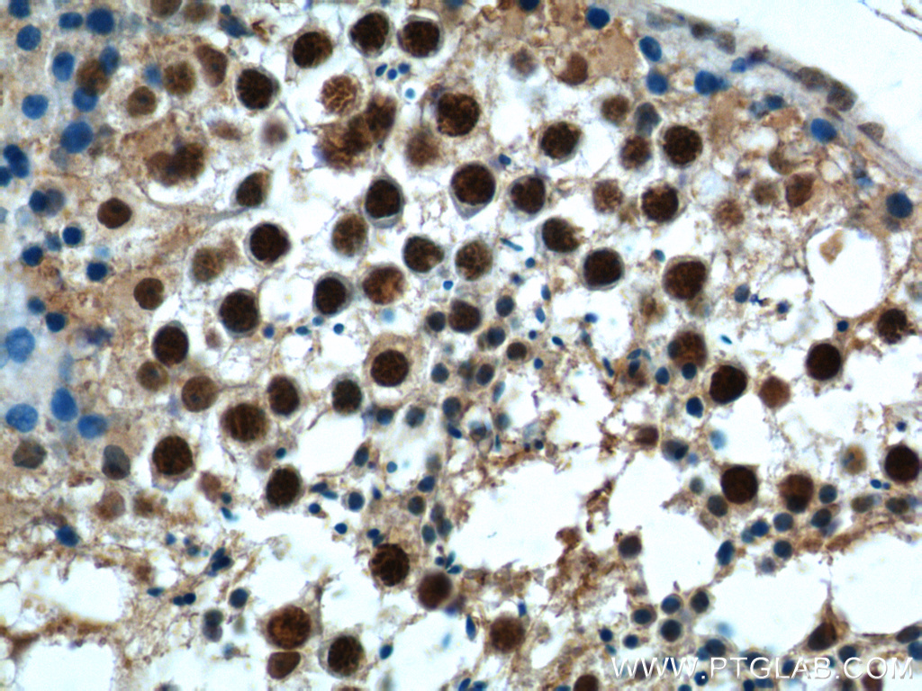 NRIP3 Polyclonal antibody