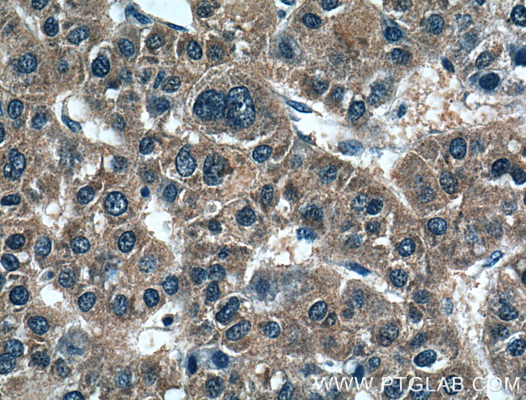 PMVK Polyclonal antibody
