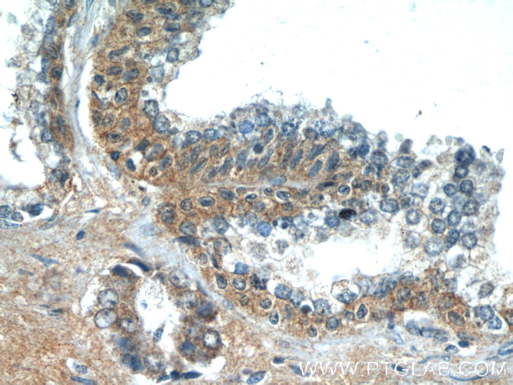 LZTS2 Polyclonal antibody