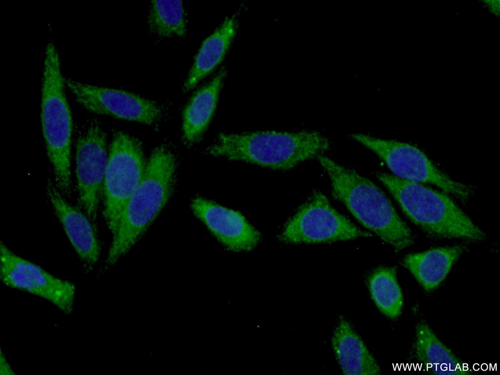 KHK Polyclonal antibody