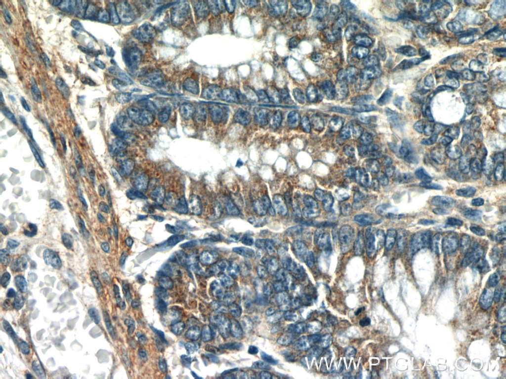 UBE2H Polyclonal antibody