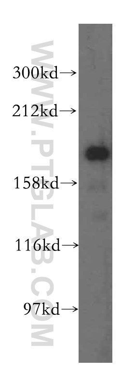 ERCC6L Polyclonal antibody