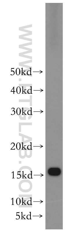 RPS20 Polyclonal antibody