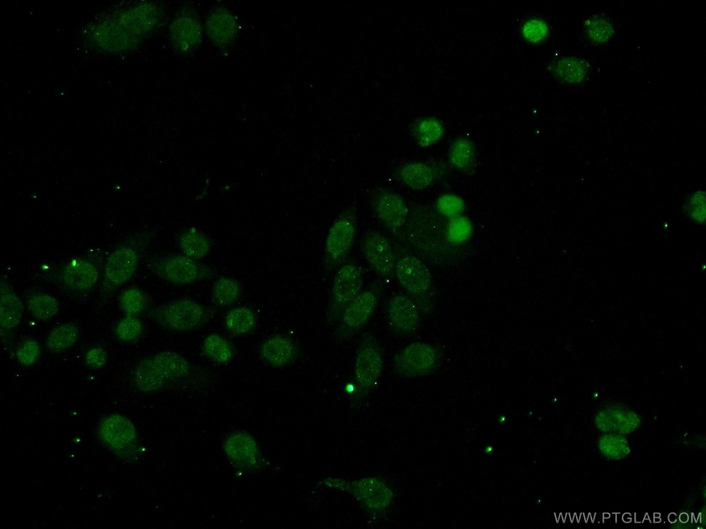 SSRP1 Polyclonal antibody