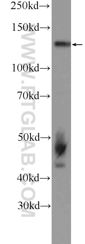 NOL6 Polyclonal antibody