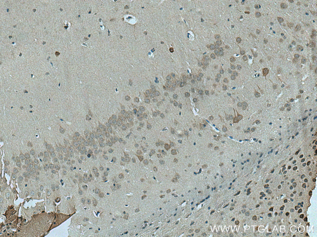 RIMBP2 Polyclonal antibody
