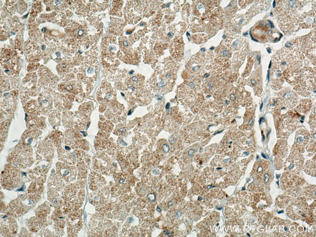 BCKDK Polyclonal antibody