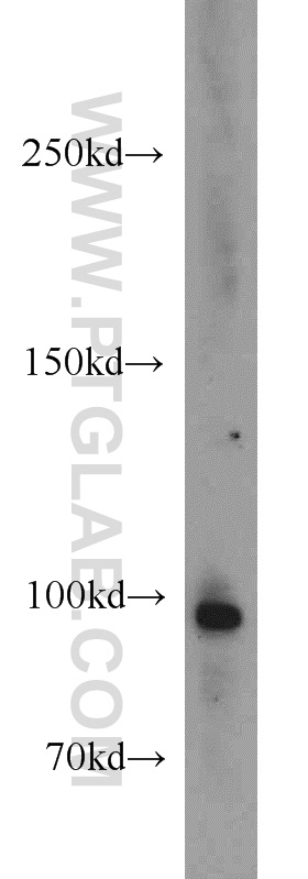 TUBGCP3 Polyclonal antibody