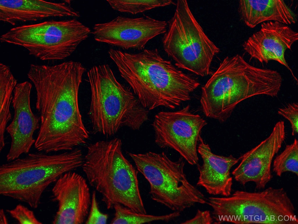 CRTAP Polyclonal antibody