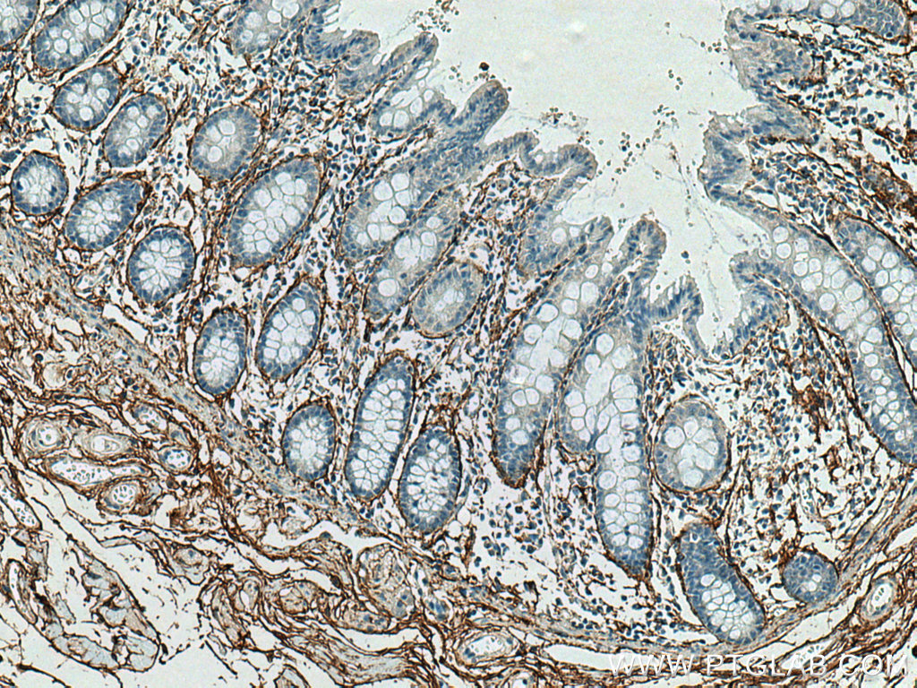 MFAP5 Polyclonal antibody