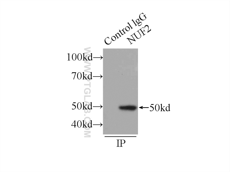 NUF2 Polyclonal antibody
