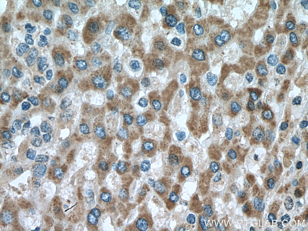 DHRS2 Polyclonal antibody