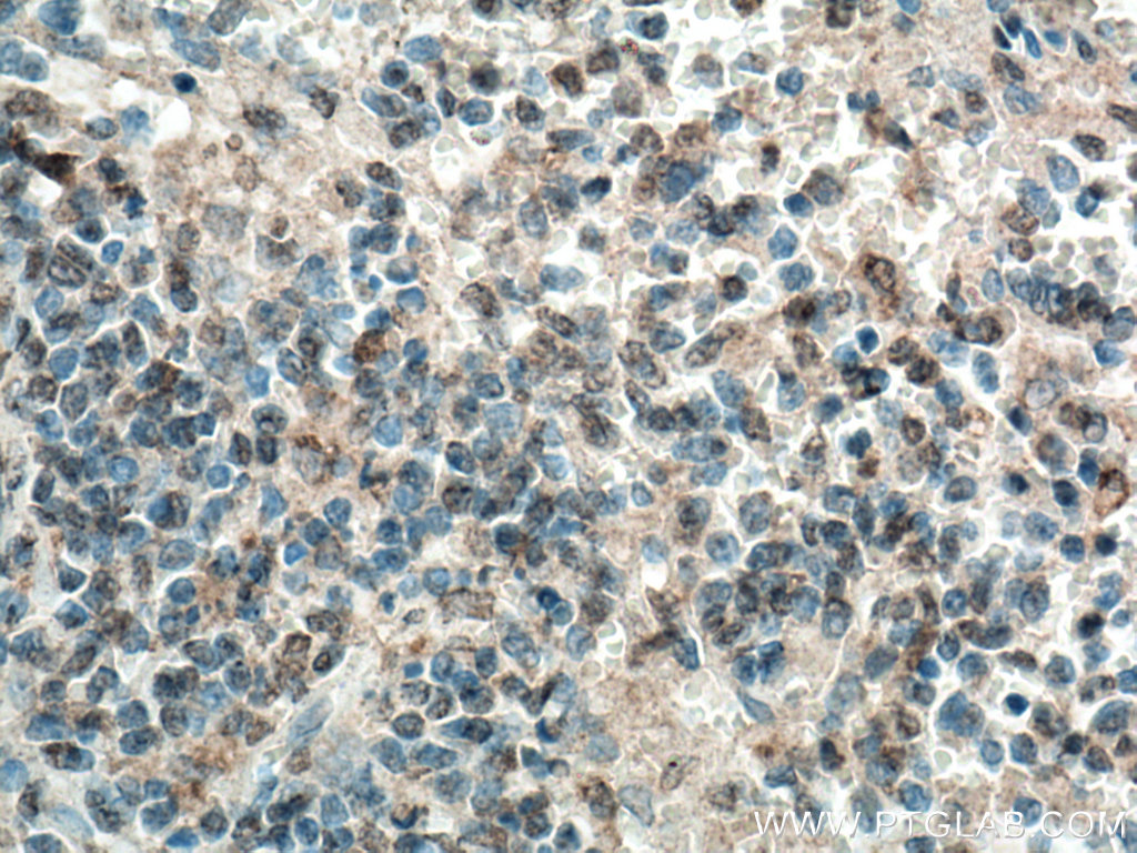 MASTL Polyclonal antibody