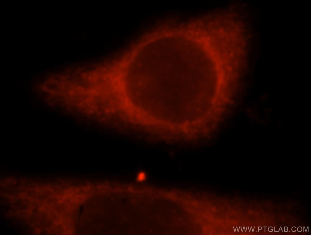 TRIM14 Polyclonal antibody