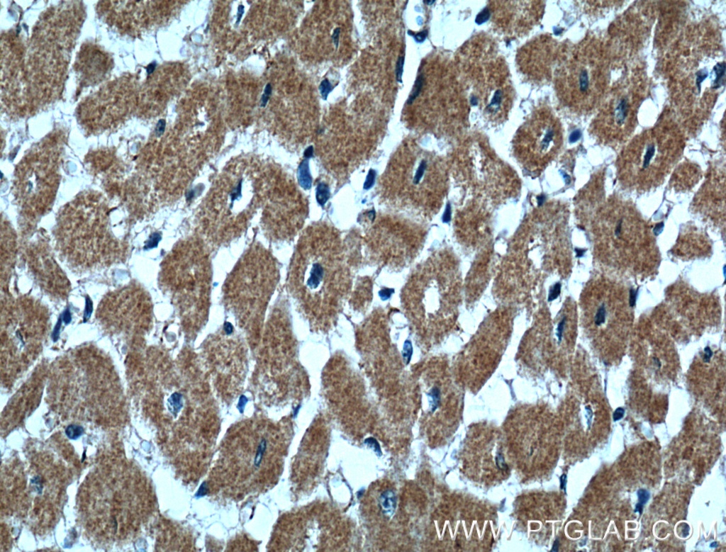 CLPB Polyclonal antibody