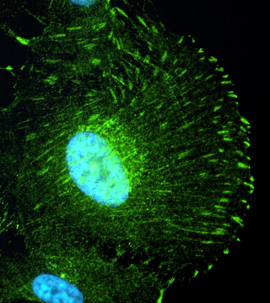 NPHP5,IQCB1 Polyclonal antibody