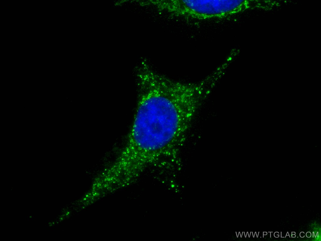MEK5 Polyclonal antibody