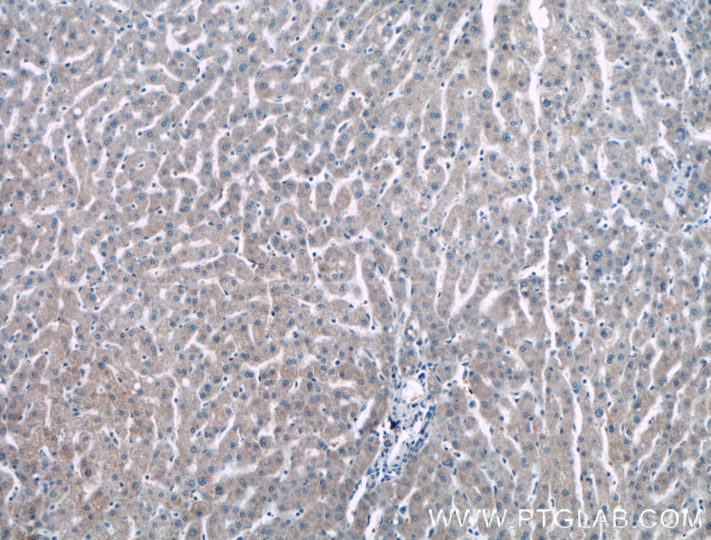 NMRAL1 Polyclonal antibody