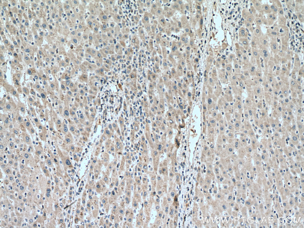 ACAD9 Polyclonal antibody