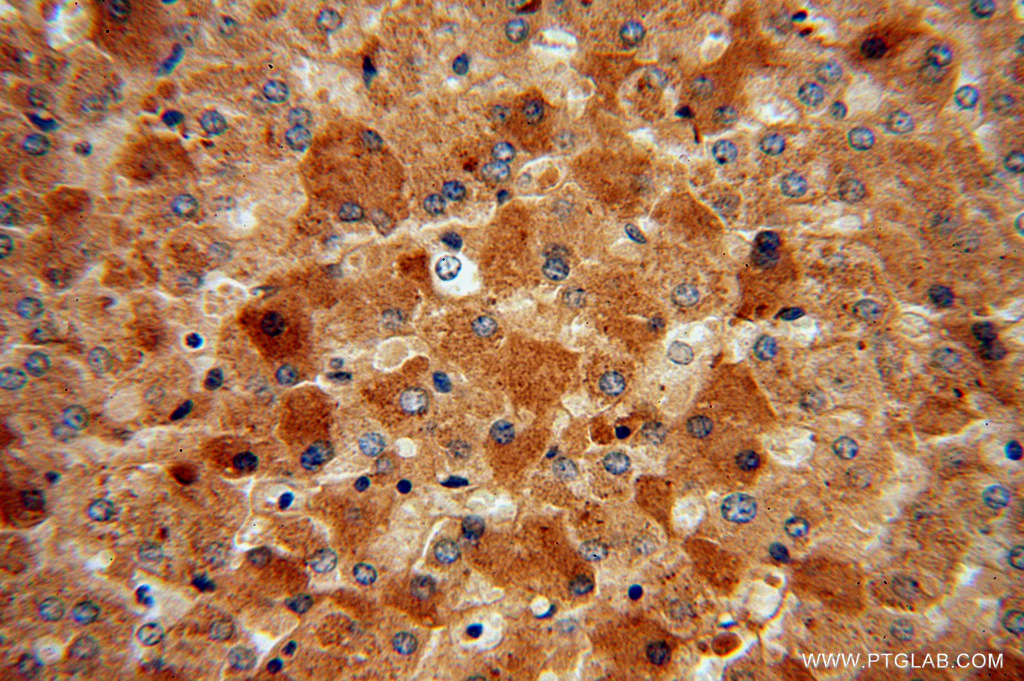 MGAT2 Polyclonal antibody