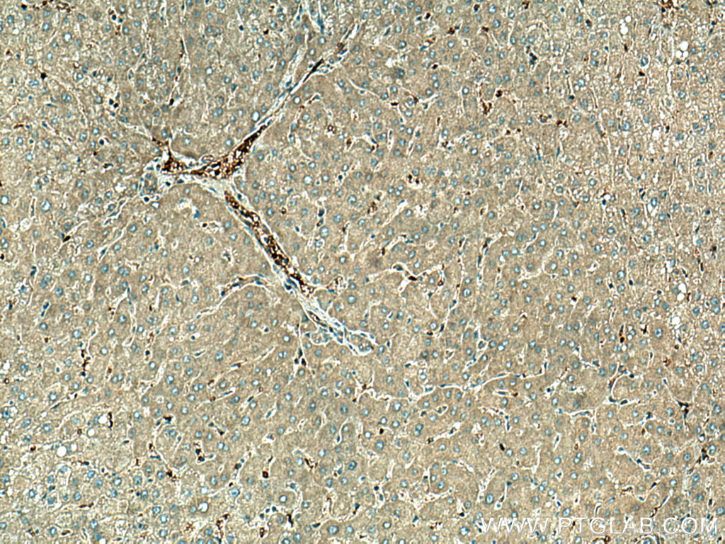 UFC1 Polyclonal antibody