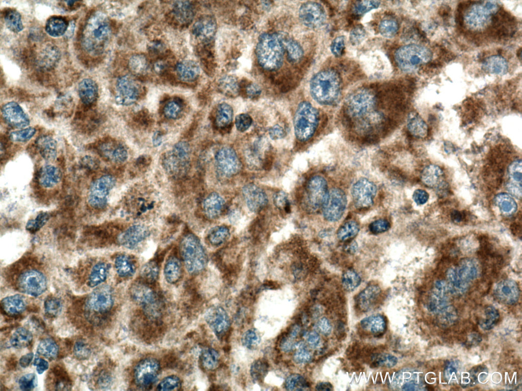 PIN4 Polyclonal antibody