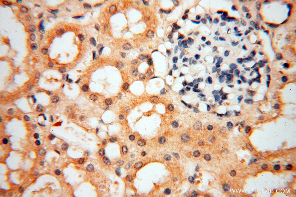 SMPX Polyclonal antibody