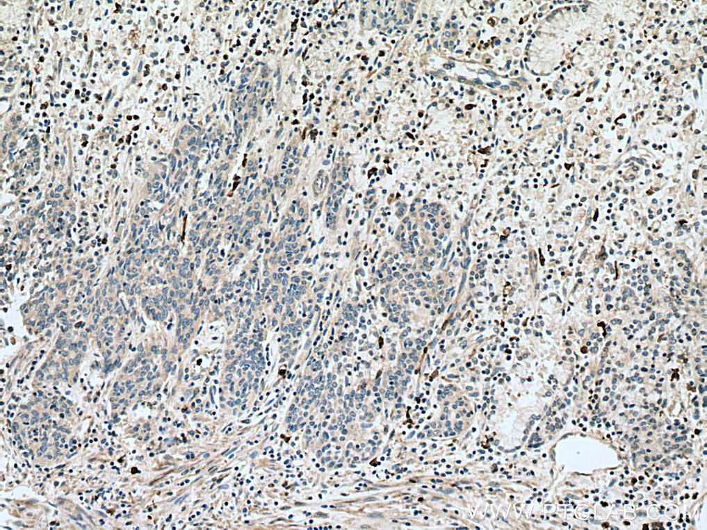 S100A8 Polyclonal antibody