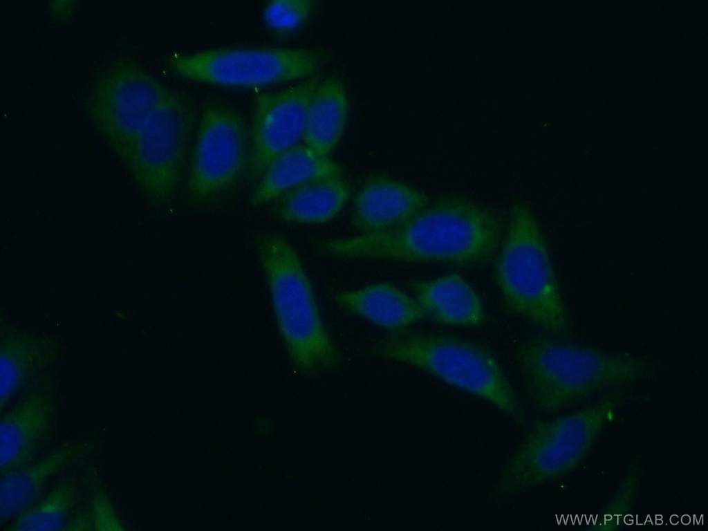RPL29 Polyclonal antibody