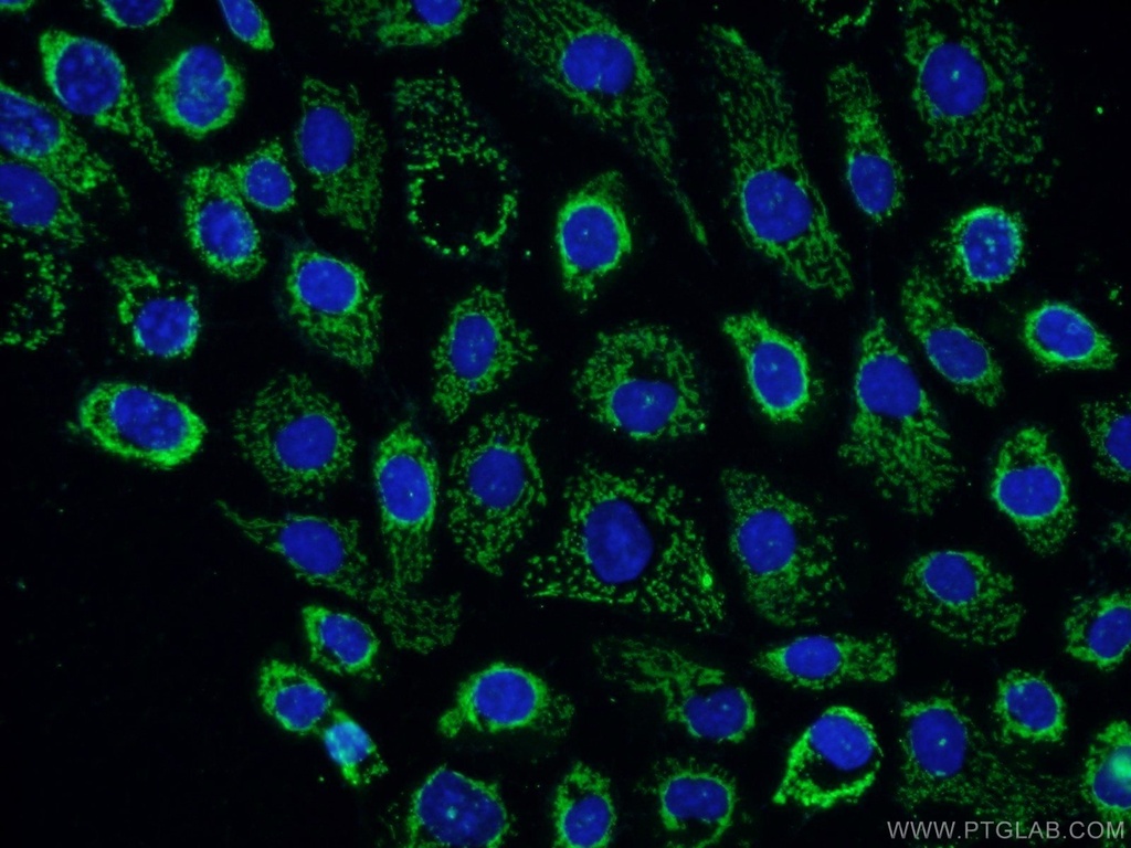 LRCH3 Polyclonal antibody