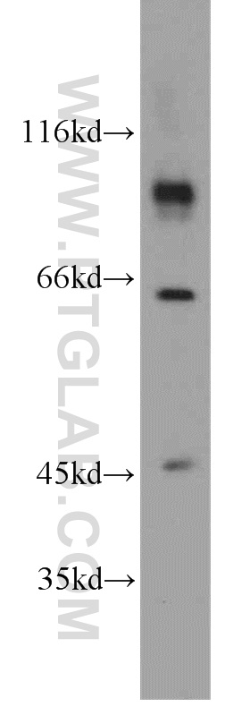CHPF-N terminal Polyclonal antibody