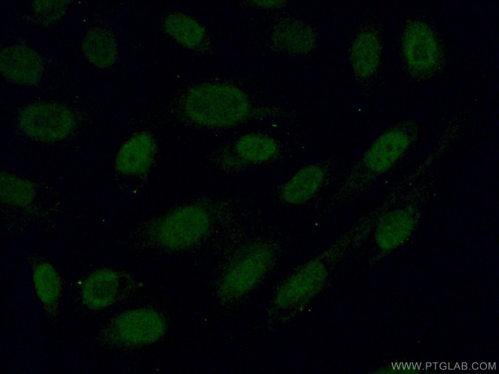 Alpha B Crystallin Polyclonal antibody