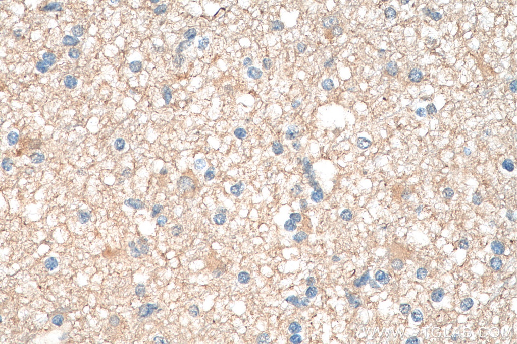 PKM1-specific Polyclonal antibody