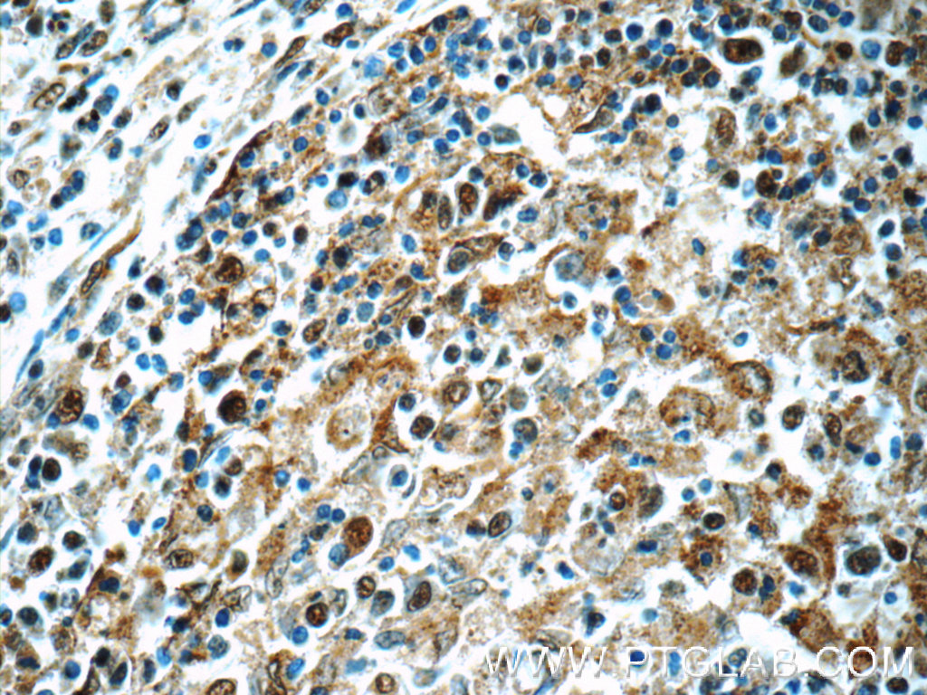 MCL1L-specific Polyclonal antibody