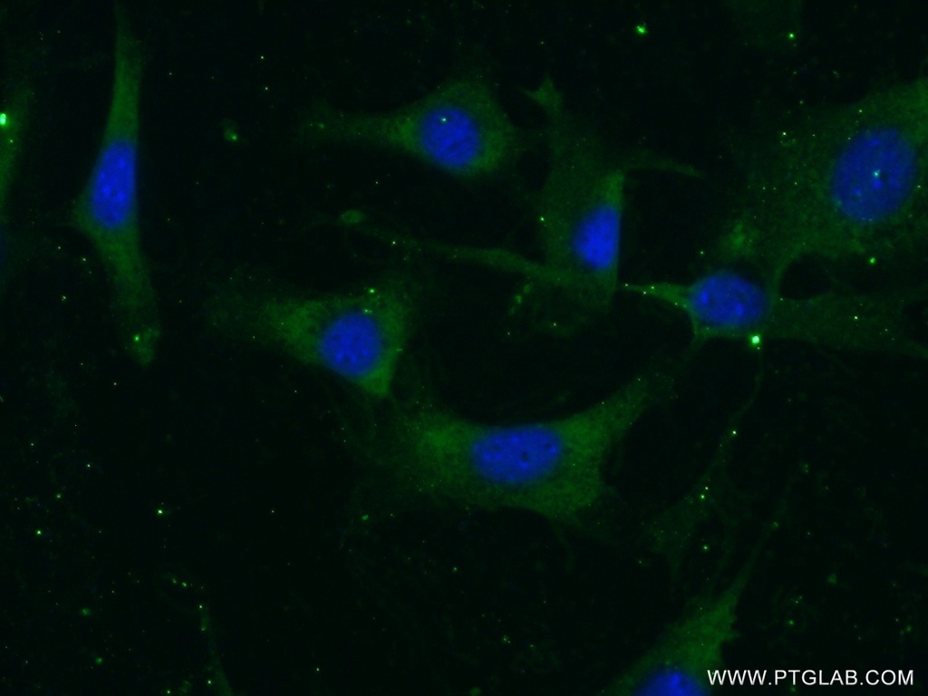 Vitronectin Polyclonal antibody
