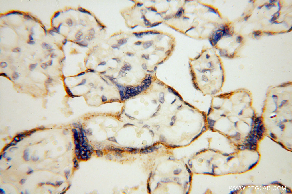 Carboxypeptidase A1 Polyclonal antibody