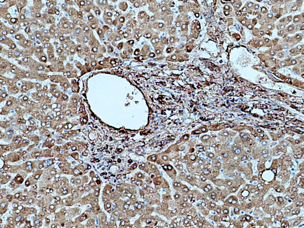 Fibrinogen Gamma Chain Polyclonal antibody