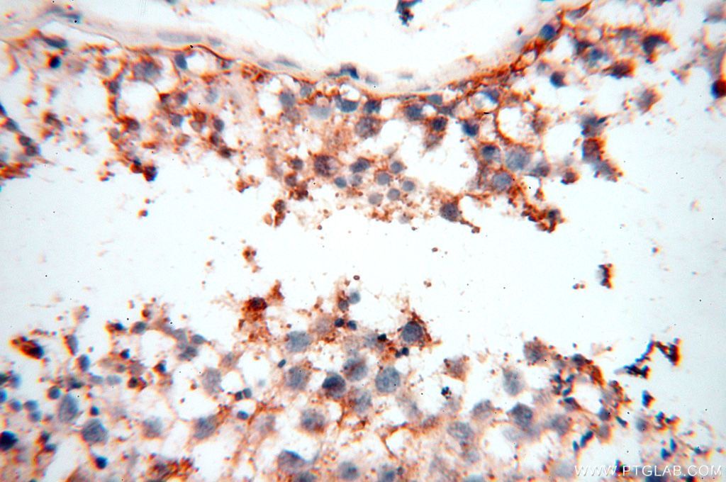 TGM4 Polyclonal antibody