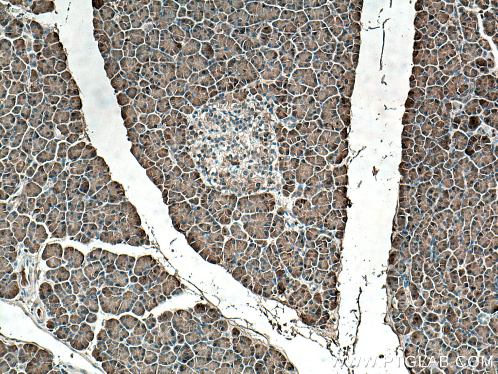REG Polyclonal antibody