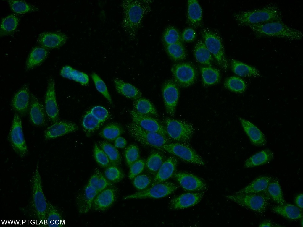 PYGL Polyclonal antibody